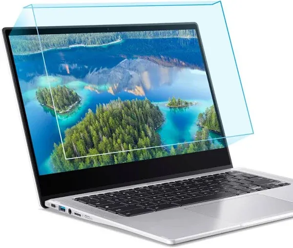 F FORITO 15.6 Inch Blue Light Blocking Laptop Screen Protector Panel, Eye Protection Hanging Type Acrylic Panel Compatible with All 15.6" Laptops with Display 16:9