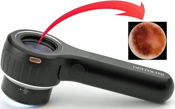 DermLite DL4 - The 4th-generation DermLite® dermatoscope