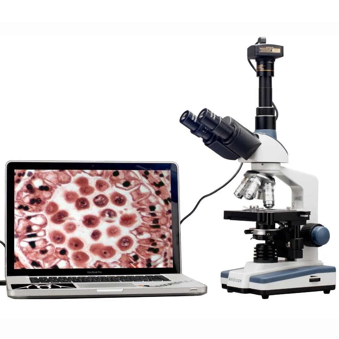 AmScope T120B-M Digital Professional Siedentopf Trinocular Compound Microscope, 40X-2000X Magnification, WF10x and WF20x Eyepieces, Brightfield, LED Illumination, Abbe Condenser with Iris Diaphragm, Double-Layer Mechanical Stage, 100-240VAC, Includes 1.3