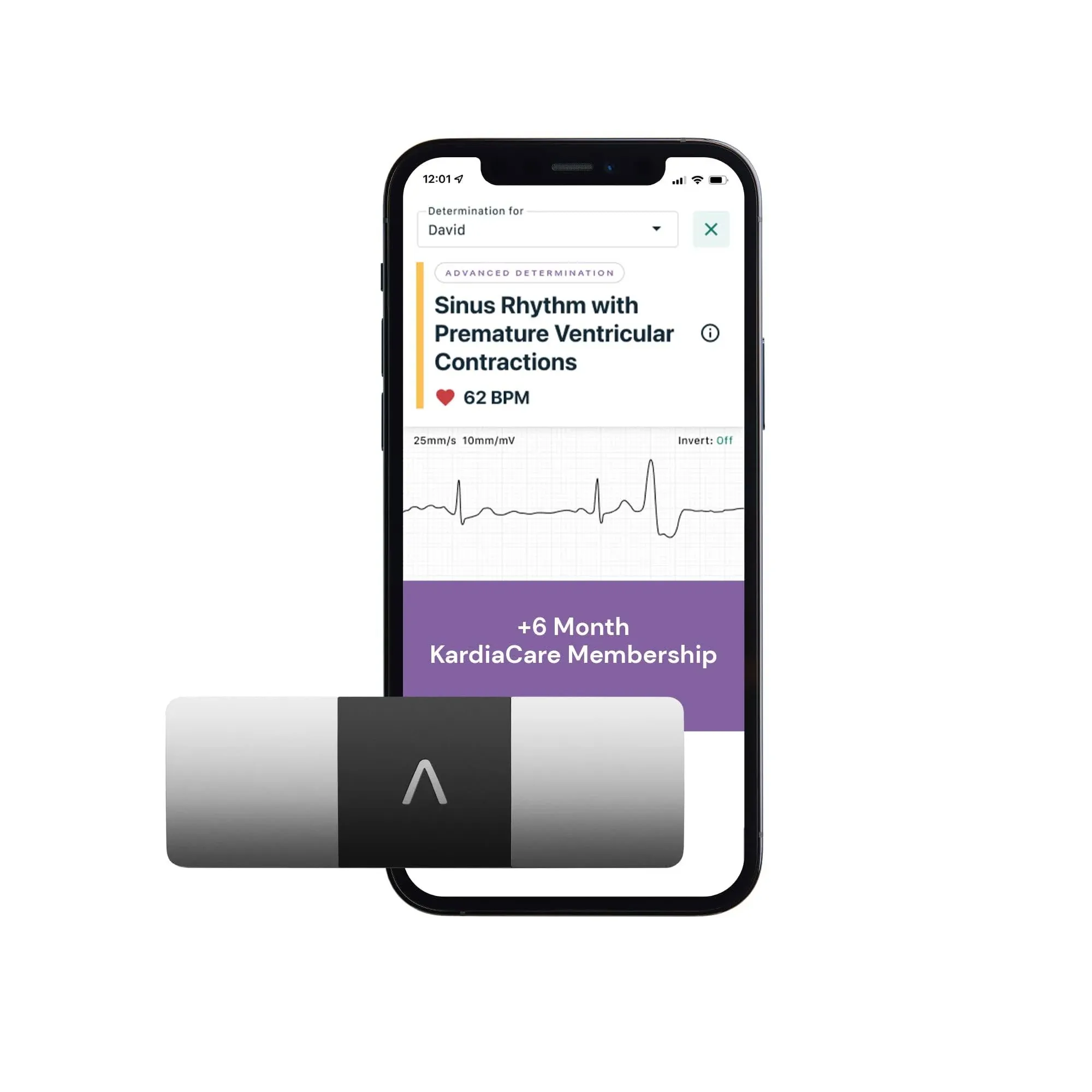 AliveCor Personal EKG Device